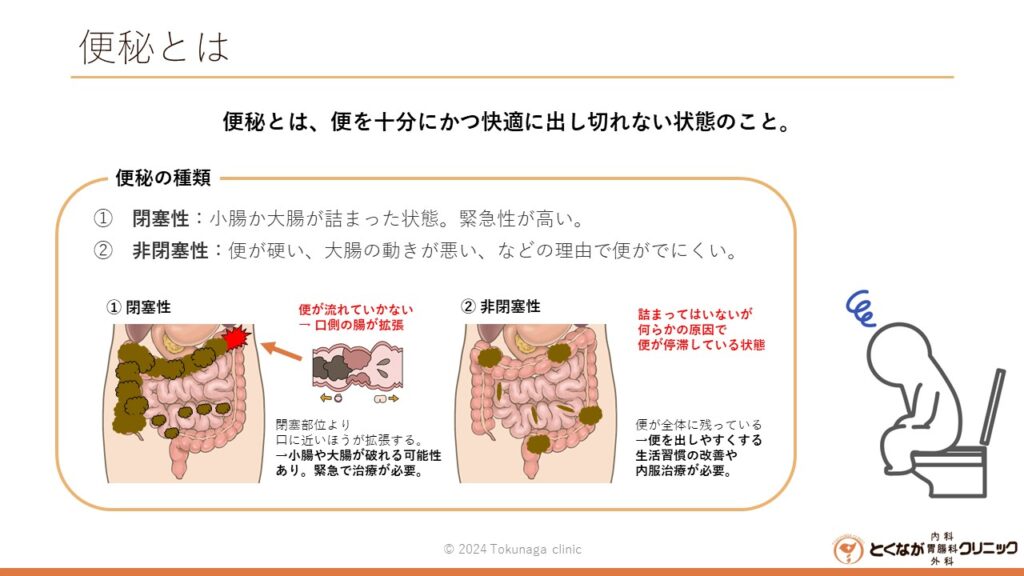便秘症 のイメージ画像